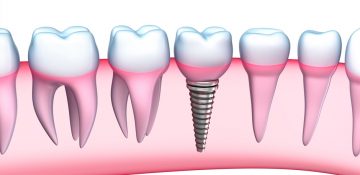 c.i.s.o., ciso, clinica odontologica cucuta, samuel fuentes, odontologia cucuta, diseño de sonrisa cucuta, cirugia oral y maxilofacial cucuta, blanqueamiento dental cucuta, endodoncia cucuta, odontologia general cucuta, rehabilitacion oral cucuta, periodoncia cucuta, odontologia, cucuta